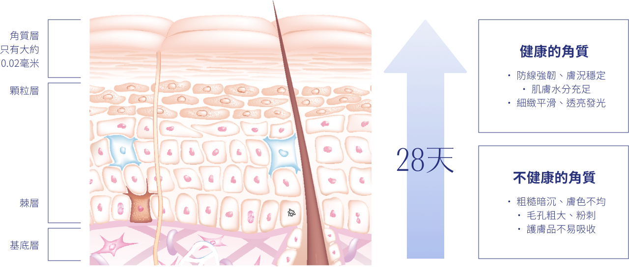 28天,健康的角質,粗糙暗啞,膚色不均,毛孔粗大,粉刺